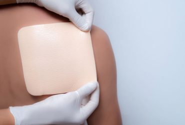 Wound dressings