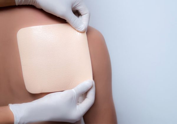 Wound dressings